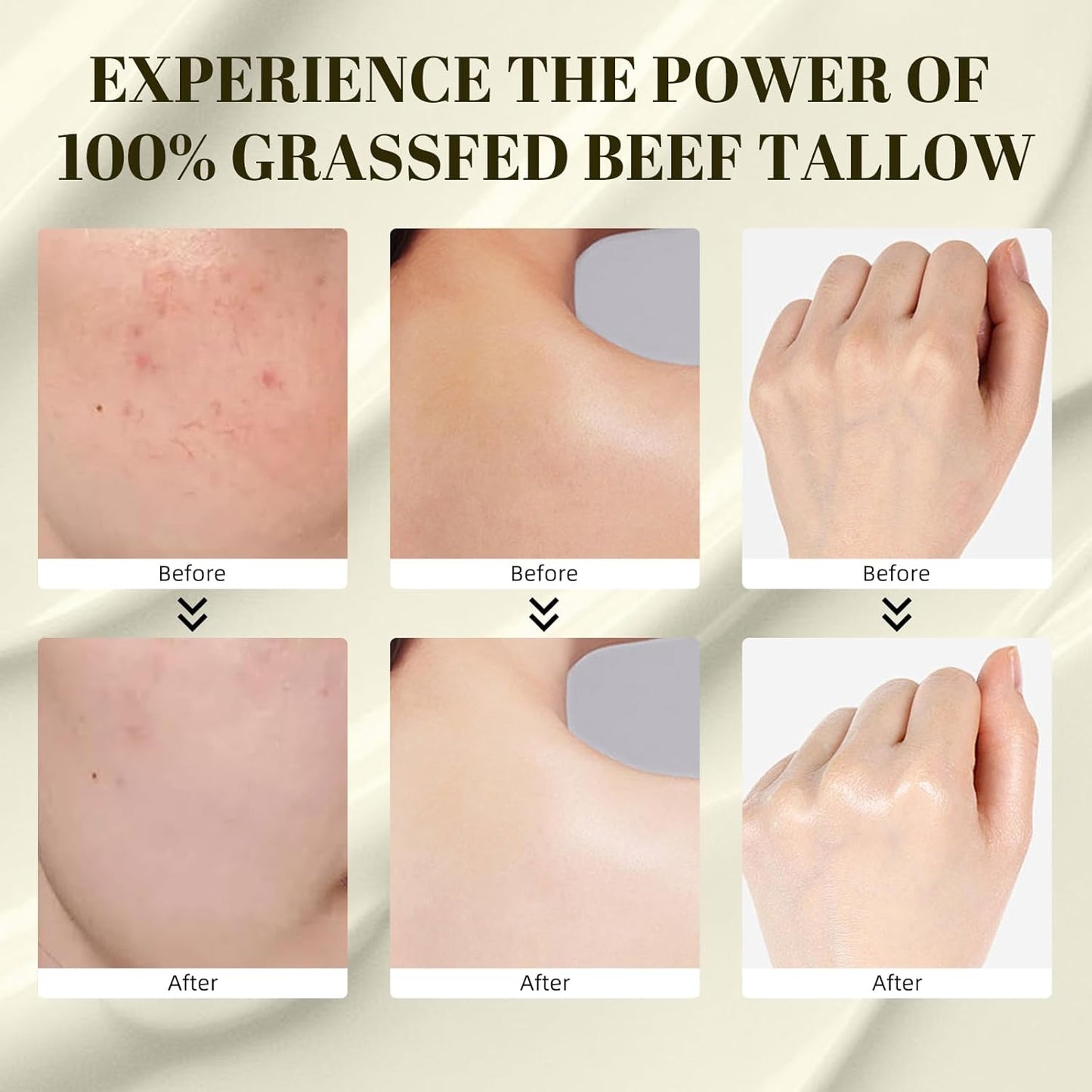 Beef Tallow for Skin, Beef Tallow, Tallow Face Moisturizer, Grass Fed Beef Tallow Grass Finished Organic Beef Tallow Balm Whipped Tallow Face Cream Moisturizer for Body Lotion Skin Care (1.7OZ)